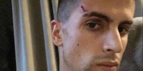 Cancelo